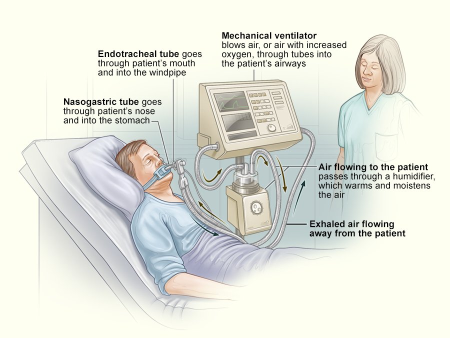 Types Of Ventilator Modes Explained In Details in 2022